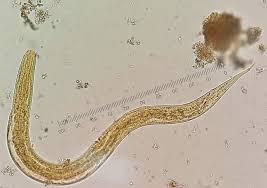 UJU-HEALT-HOLIS-0014-Parasites in the Native Community